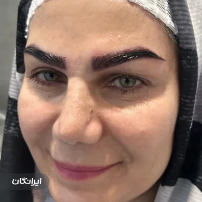 کلینیک کاشت مو شکیل