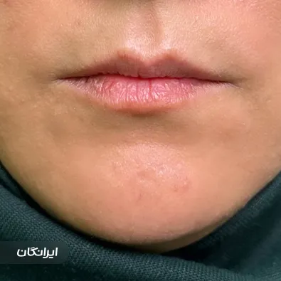 کلینیک زیبایی رز سفید