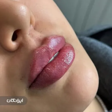 کلینیک زیبایی آفرودیت