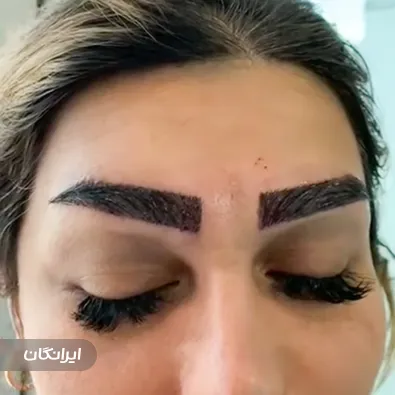 کلینیک کاشت ابرو و مو هیرتاک