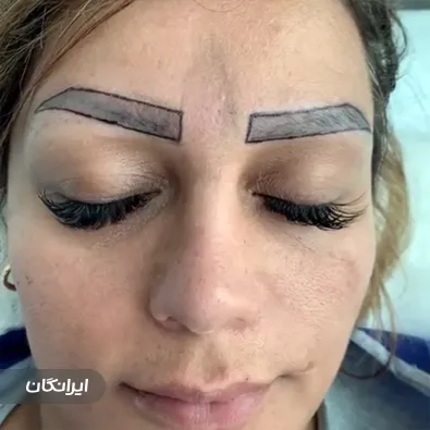 کلینیک کاشت ابرو و مو هیرتاک
