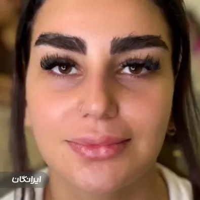 کلینیک زیبایی مبینا الحانی