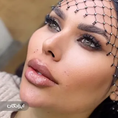 کلینیک زیبایی مبینا الحانی