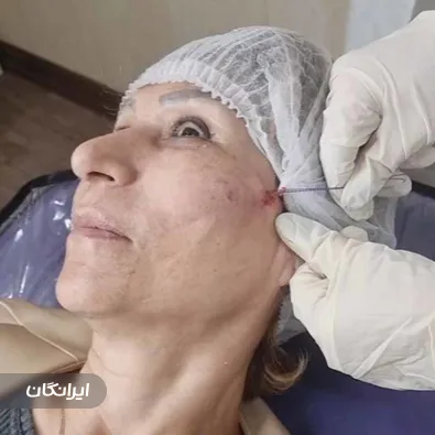 کلینیک زیبایی فاطمه بروایه