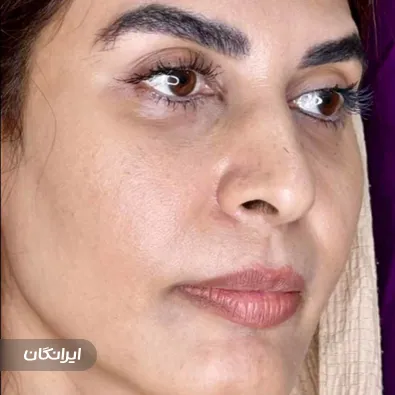 کلینیک زیبایی فاطمه بروایه