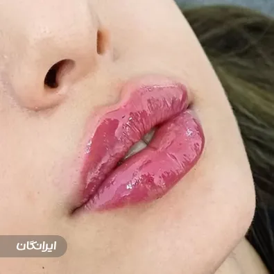 کلینیک زیبایی لئا