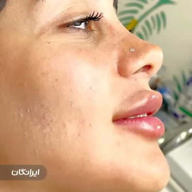 کلینیک زیبایی آینا