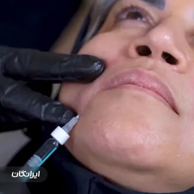 کلینیک زیبایی کربن