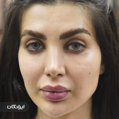 سالن زیبایی چیمن