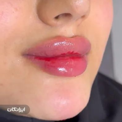 کلینیک زیبایی ثنا