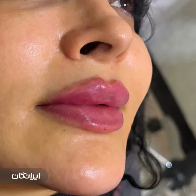 کلینیک زیبایی ثنا