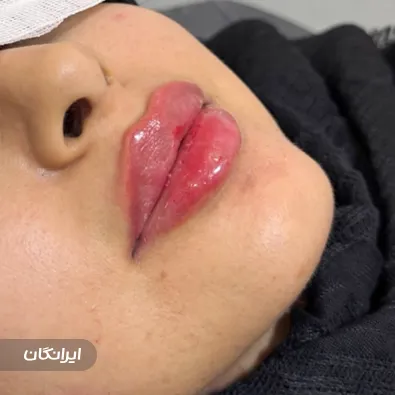 کلینیک زیبایی ثنا