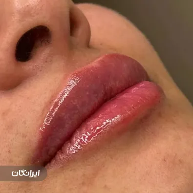 کلینیک زیبایی نازنین