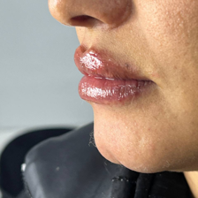 کلینیک زیبایی شاین