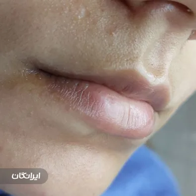 سالن آرایش دائم محمدی