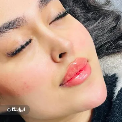 کلینیک زیبایی نسترن