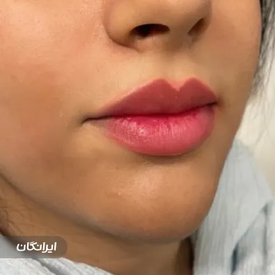 کلینیک زیبایی نسترن