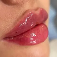 کلینیک زیبایی نسترن