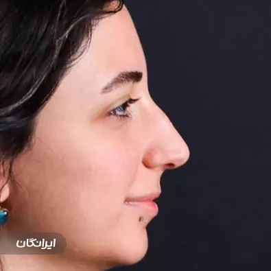 کلینیک تهران پلاستیک