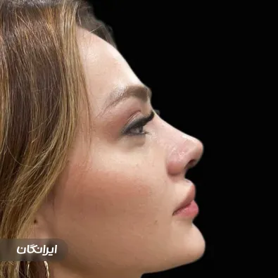 کلینیک تهران پلاستیک