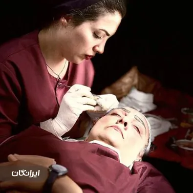 کاشت ابرو نسیم تشکری