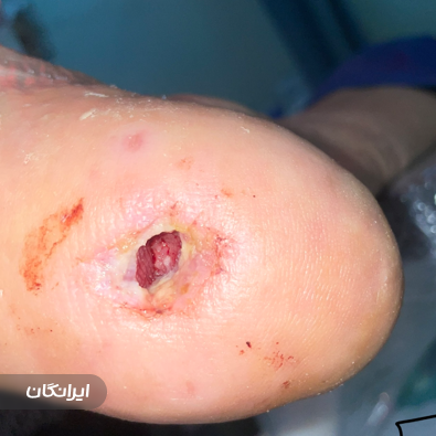 کلینیک زخم گیو