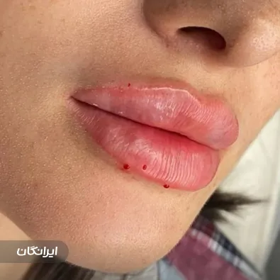 کلینیک زیبایی آیلار