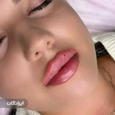 کلینیک زیبایی آیلار