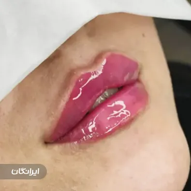 کلینیک زیبایی آیلار