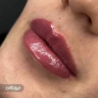 کلینیک زیبایی لیا
