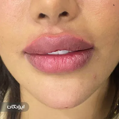 کلینیک زیبایی لیا