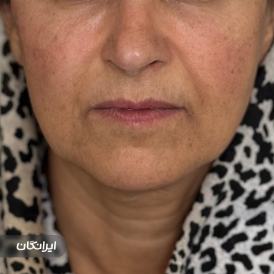 کلینیک زیبایی دکتر علیرضا رزم آهنگ