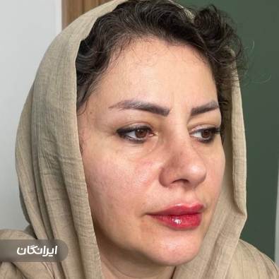 کلینیک زیبایی اپالیوم