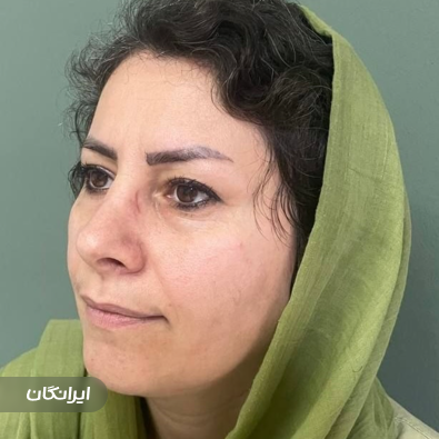 کلینیک زیبایی اپالیوم
