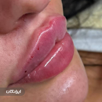 کلینیک زیبایی بیوتی فول سیتی