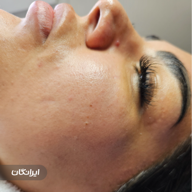 مرکز پاکسازی پوست هدیوا بیوتی