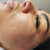 مرکز پاکسازی پوست هدیوا بیوتی