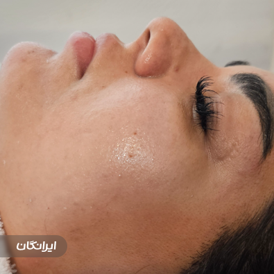 مرکز پاکسازی پوست هدیوا بیوتی