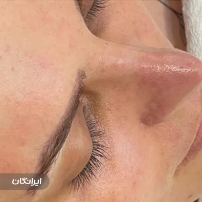 مرکز پاکسازی پوست فرد