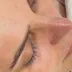 مرکز پاکسازی پوست فرد