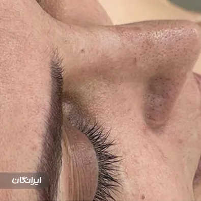 مرکز پاکسازی پوست فرد