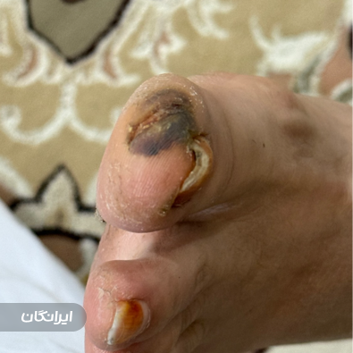 مرکز درمان زخم امیررضا معصومی