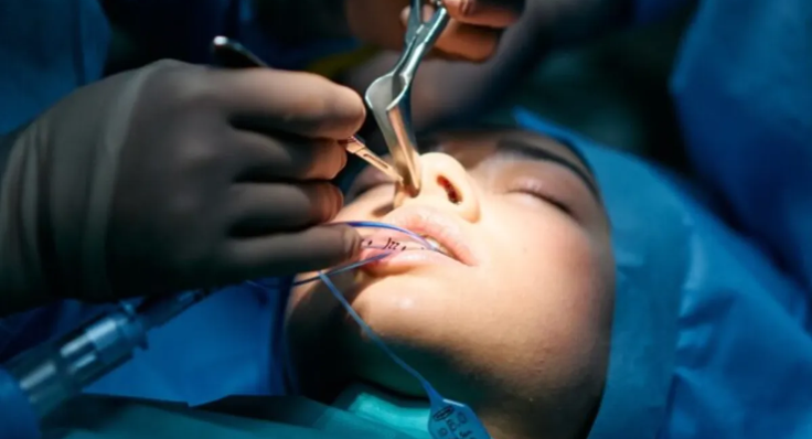 جراحی زیبایی بینی